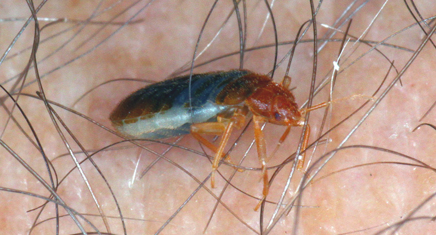 Bed bug on human skin